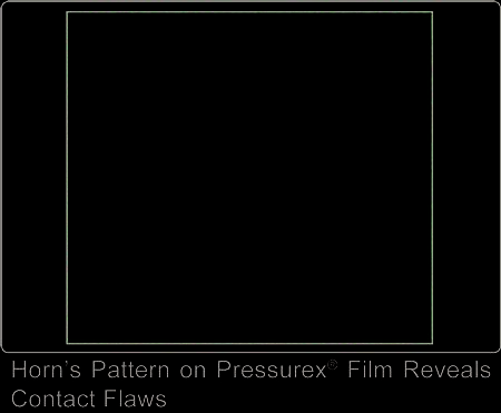 Horn's Pattern on Pressurex Reveals Contact Flaws